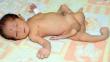 Bebé nace con seis piernas en Pakistán
