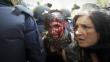 Jornada de protesta minera en Madrid deja 76 heridos