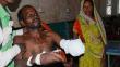 India: Patrón amputa la mano a un trabajador por exigir pago de deuda