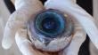 EEUU: El gran globo ocular encontrado en Florida sería de un pez espada