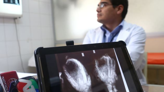 JUEGO FATAL. Radiografía muestra los daños que sufrió el menor. (Rafael Cornejo)