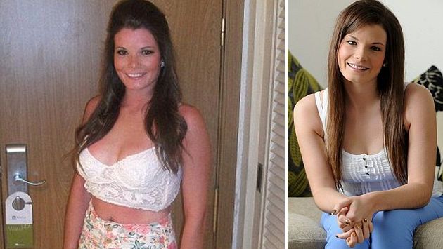 Fiona antes (izq.) y después (der.) de someterse a la doble mastectomía. (Daily Mail)