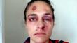 Video viral de mujer golpeada era parte de una campaña de concienciación
