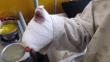 Cusco: Niño de nueve años pierde dedos por pirotécnico