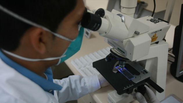 Se esperan más pruebas de otros pacientes. (Perú21)