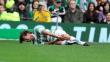Louis Tomlinson de 'One Direction' se lesiona durante partido benéfico