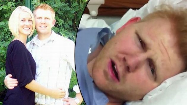 Jason Mortensen, antes y después de la operación. (Internet)