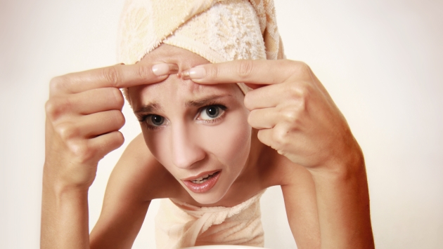 La aparición de acné en mujeres adultas suele estar relacionado con problemas ginecológicos. (USI)