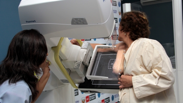 La mamografía es una prueba indispensable. (USI)