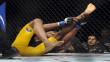 Anderson Silva y su grave fractura de tibia en la UFC [Fotos]