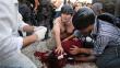 Brasil: Camarógrafo brasileño golpeado en protestas con muerte cerebral