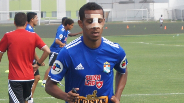 Sporting Cristal: Junior Ross jugaría con máscara ante Juan Aurich. (USI)
