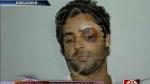 Nahel Tubbeh quedó con el rostro desfigurado. (América TV)
