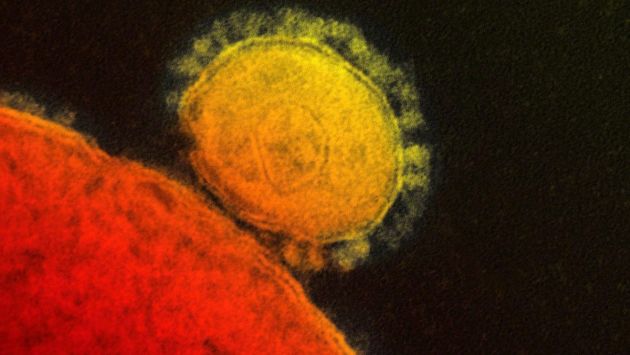 Estados Unidos confirma primer caso de mortal virus de Oriente Medio. (AP)