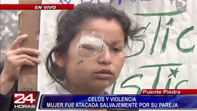 Jesús Quiroz atacó con un cuchillo a Carolina Godo Vega, quien presenta lesiones en uno de los ojos producto del ataque. (24 Horas)
