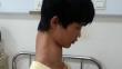 China: Caso del ‘chico jirafa’ conmocionó al país