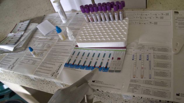 Dos hombres se habrían curado por integración del VIH en su ADN. (AFP)