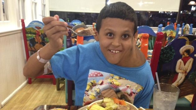 Extirparon tumor a niño mexicano de 11 años. (Reuters)