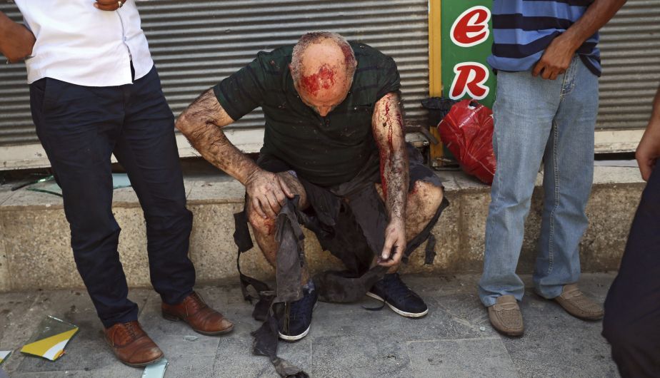 Al menos 30 muertos y 100 heridos en Turquía por atentado suicida (EFE)