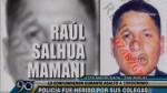 Raúl Salhua Mamani fue herido en la cabeza por un colega que lo confundió con asaltante (Frecuencia Latina).