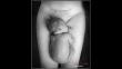 Facebook: La foto de una cicatriz tras una cesárea se hizo viral y este fue el motivo