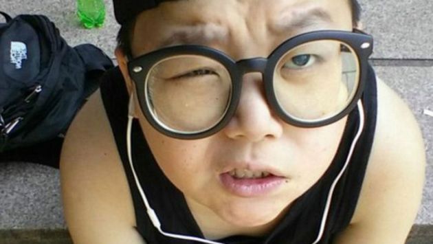 Los medios coreanos publicaron que Hyomyung era portador de un síndrome raro, llamado 'Highlander' (BBC).