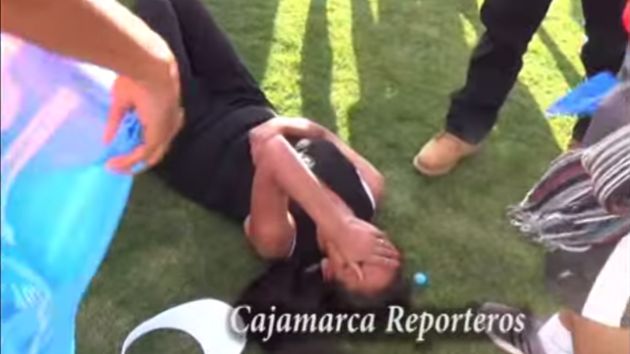 Periodista de Cajamarca recibió agresiones de los jugadores del Santa Ana. (Cajamarca Reporteros)