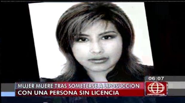 Breña: mujer murió por someterse a liposucción clandestina. (América)