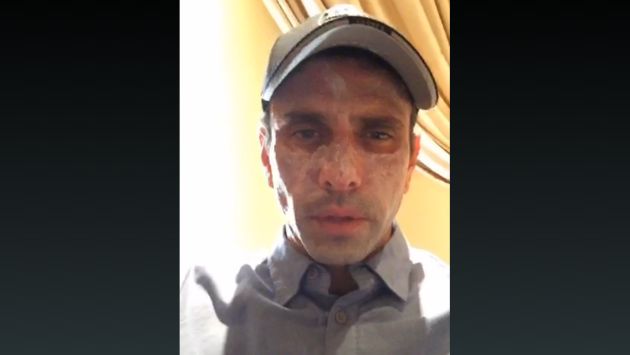 Henrique Capriles descartó que lesiones en su rostro sean cáncer a la piel. (Captura de video)