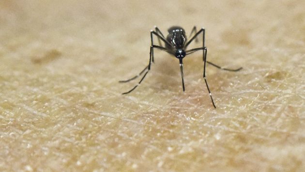 Zika tiene relación con la microcefalia, según estudios de Estados Unidos. (AFP)