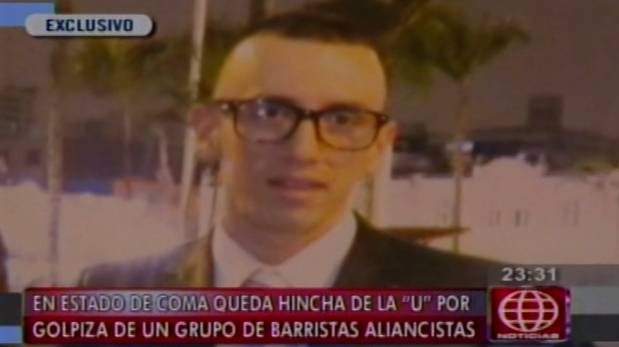 Hincha de la 'U' quedó en coma tras agresión de hinchas de Alianza Lima. (América Noticias) 
