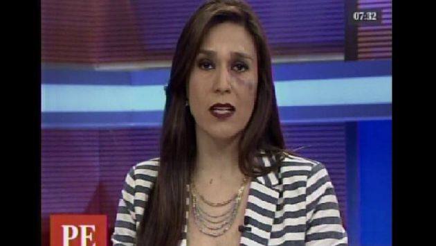 Verónica Linares apareció con el ojo morado en vivo por una buena razón. (Captura de video)
