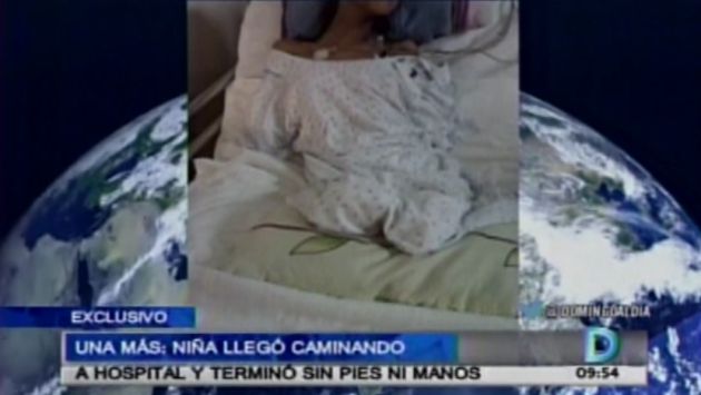 Amputan manos y pies a adolescente de 16 años que ingresó con fiebre a hospital Guillermo Almenara. (Captura de video)