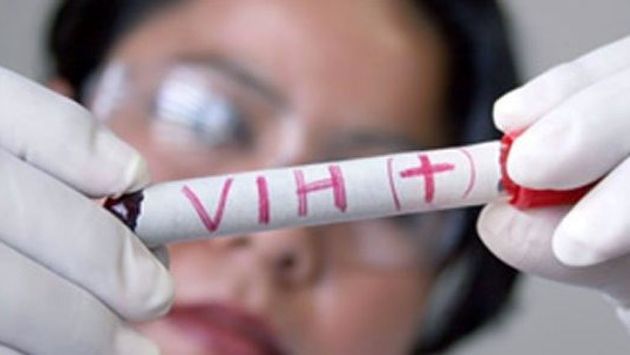 Científicos que investigan la cura del VIH afirman que aun queda un largo camino. (Trome)