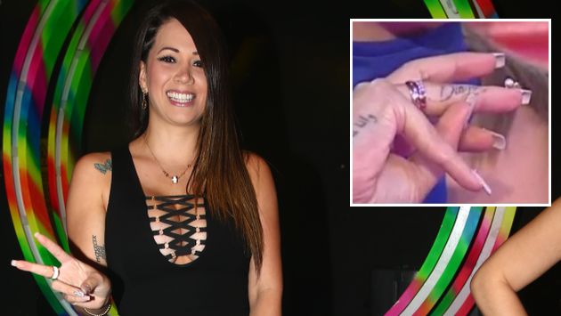 Melissa Klug se borró tatuaje con el nombre de Diego Chávarri. (USI)