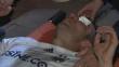 Robin Van Persie podría perder el ojo izquierdo tras recibir un codazo [Video]