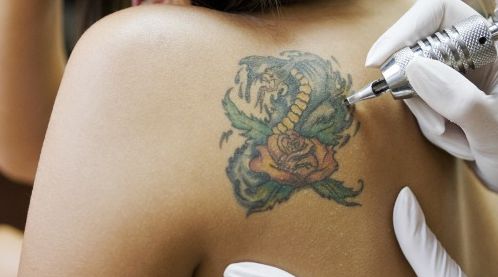 ¿Eres amante de los tatuajes o quieres hacerte uno? Ten en cuenta estas advertencias. (USI)