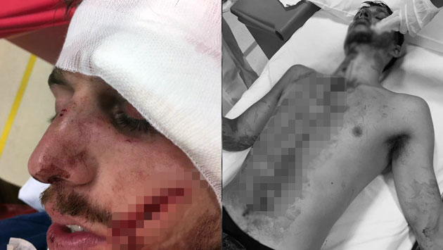 Estudiante quedó desfigurado tras agresión en discoteca de Miraflores. (BV Sa Sa / Facebook)
