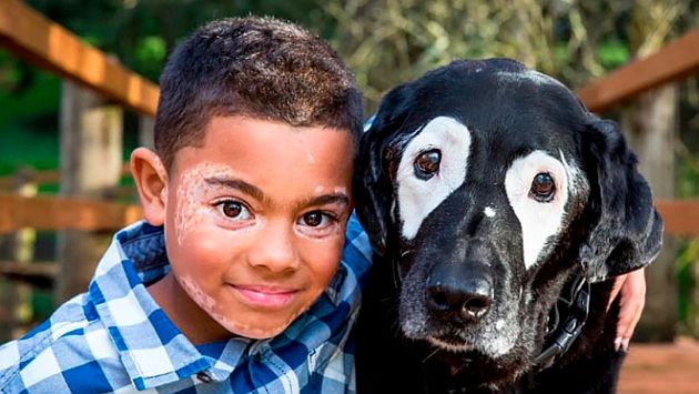 Un niño salió de la depresión tras conocer a un perro con su misma enfermedad. (Instagram white_eyed_rowdy)
