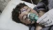 Siria: Nefasto ataque químico deja al menos 86 muertos y enciende alerta internacional [Fotos]

