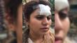 Sujeto desfigura a joven en Chiclayo porque no aceptó bailar con él [VIDEO]