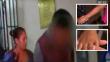 Rímac: Detienen a mujer por golpear con un palo a su hijastra de 7 años [VIDEO]