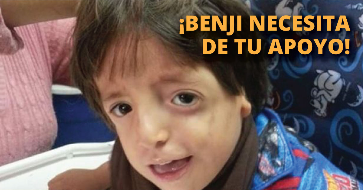 Benji ha sido hospitalizado numerosas veces a causa de su enfermedad.
