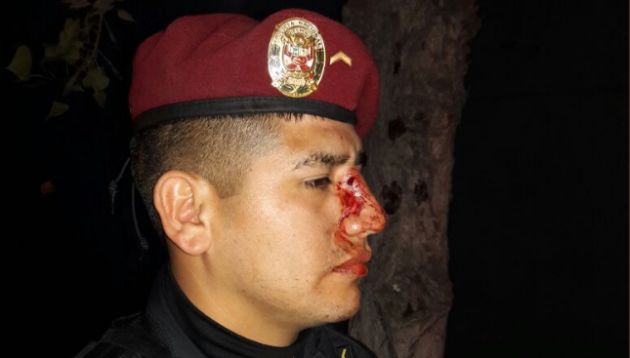 Chacarilla: Policía es agredido por dos sujetos en aparente estado ebriedad. (PNP)